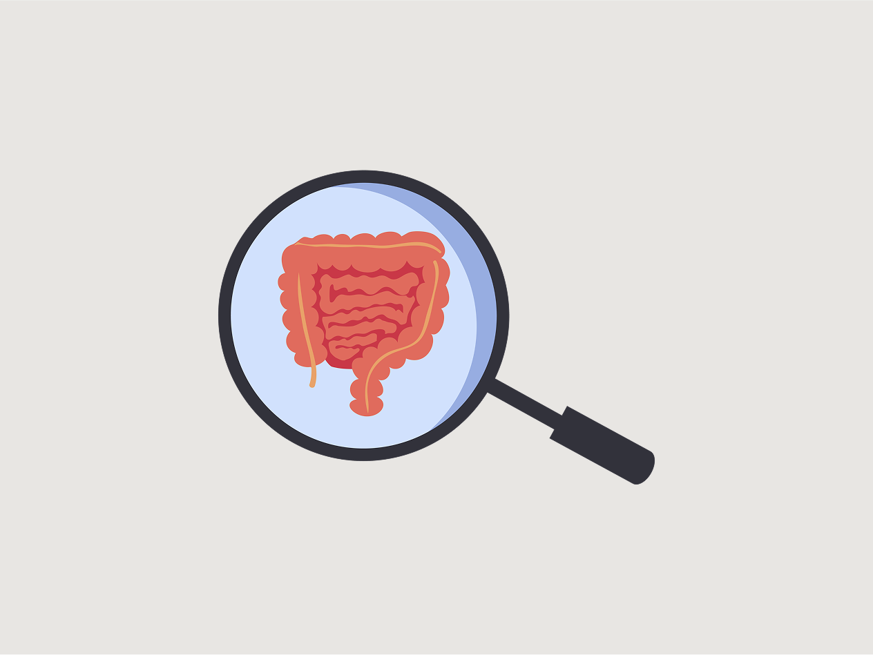 Fistulas and fissures